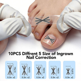 Niifawh elastic TPE silicone band worn on nail area for comfort