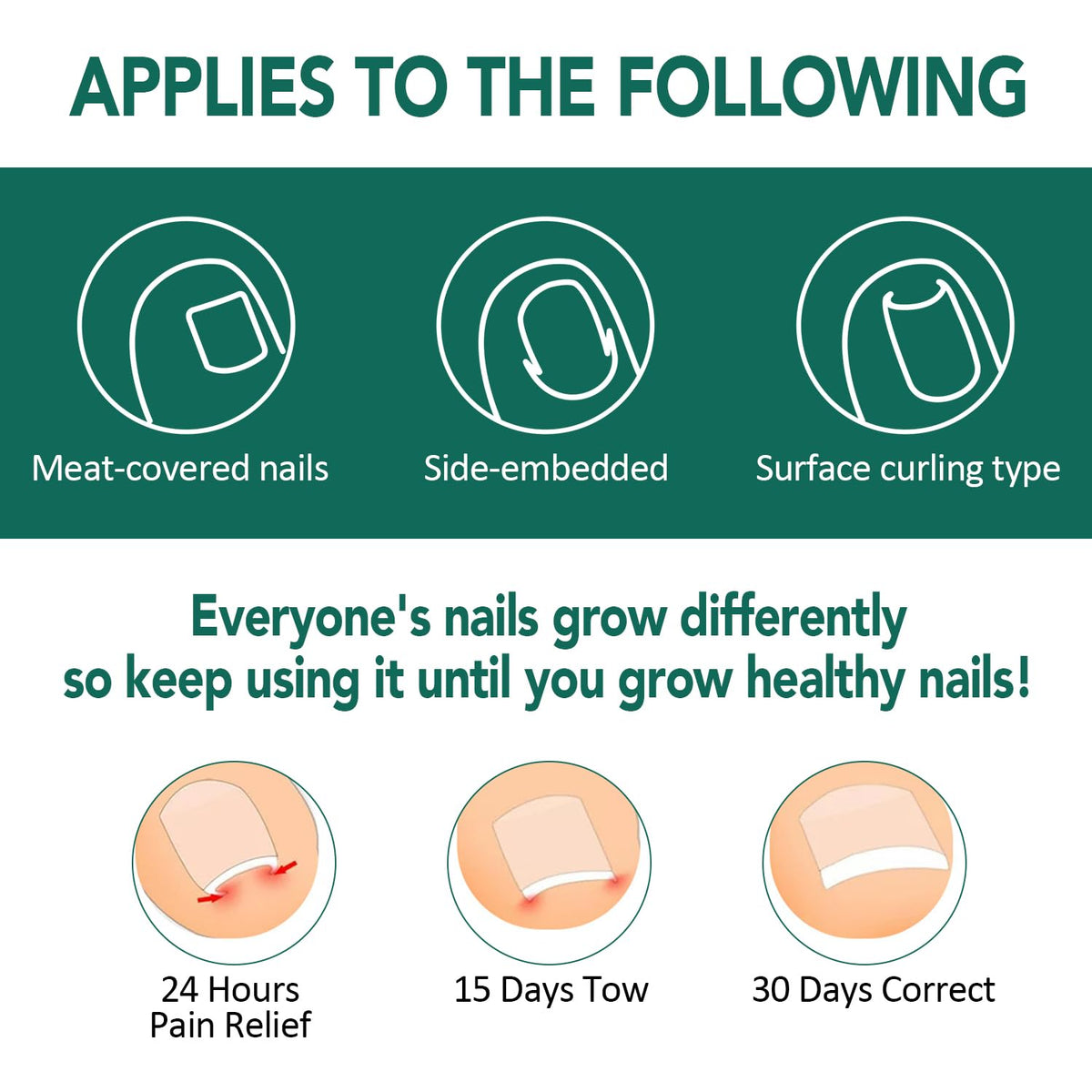 Trimmed Niifawh strip fitting varying toenail shapes.