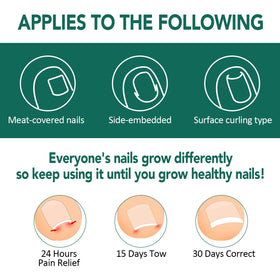 Trimmed Niifawh strip fitting varying toenail shapes.