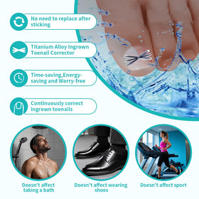 All-day comfort and secure fit of the NimbleAid toenail corrector during daily activities.