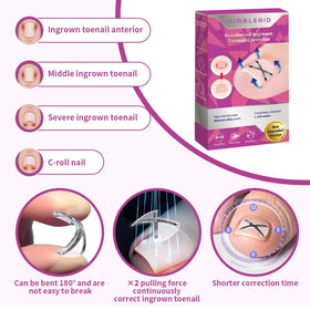NimbleAid curved toenail straightener with two styles kit for precise fit