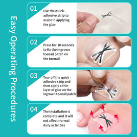 Waterproof NimbleAid corrector designed to be worn during showers and workouts.