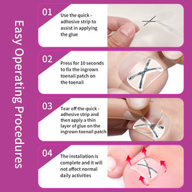 NimbleAid two styles strips included for universal toenail sizing
