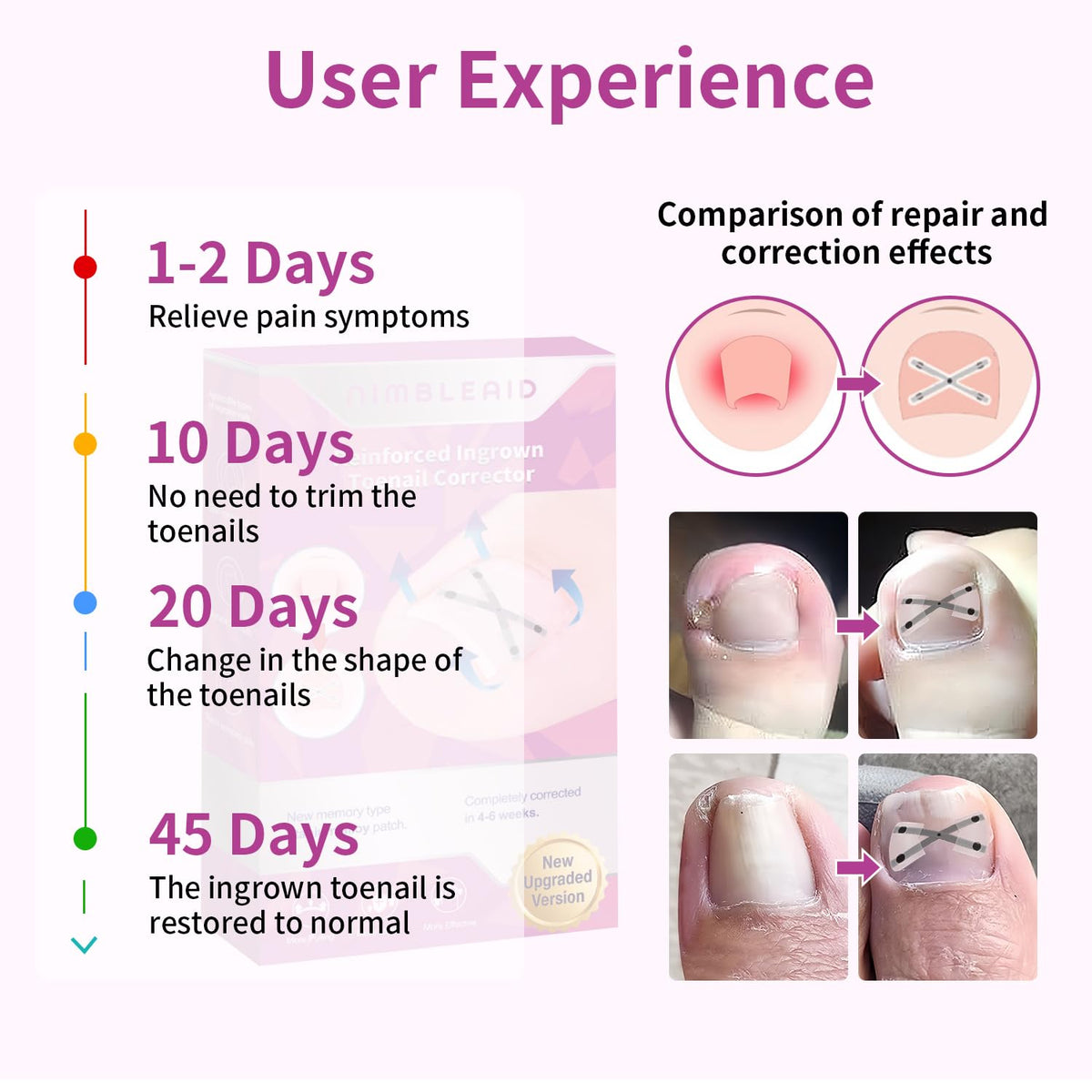 NimbleAid memory titanium alloy strips close-up for long-lasting correction