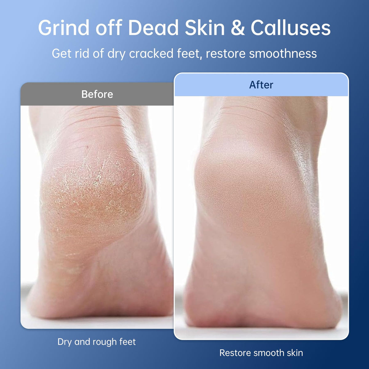 Cordless Niomuis foot file designed for travel without cords.