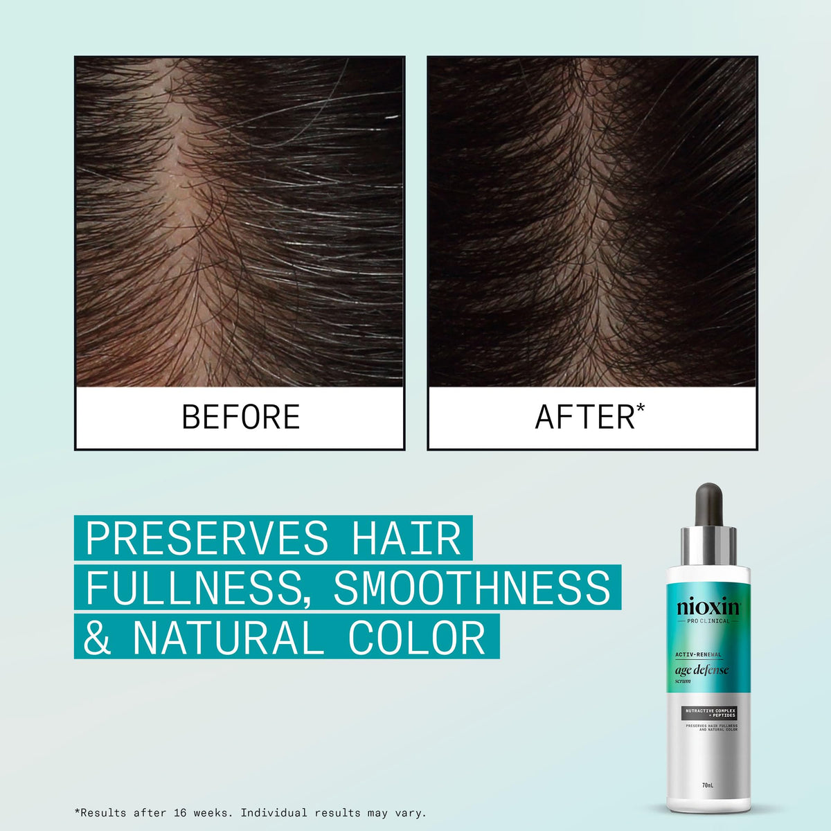 Nioxin Age Defense Serum application demonstrates easy scalp treatment.