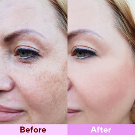 Nityrliv Bio-Collagen Real Deep Mask worn overnight for hydration