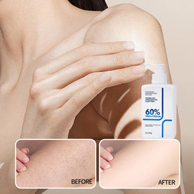 NIZENTA Urea Cream packaging shown as gift-ready.