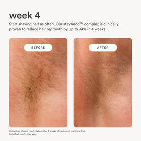 Nood Serum brightening skin close-up suggests immediate radiance after use