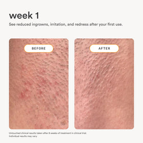 Nood Serum with ceramides strengthens the skin barrier and keeps moisture