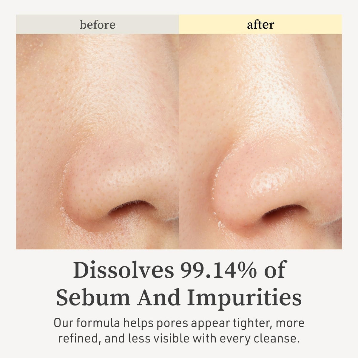 NOONI cleansing oil penetrates pores to purify and reduce impurities for a clear complexion