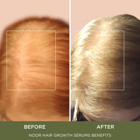 NOOR HAIR serum on scalp and strands highlights nourishing support for follicles