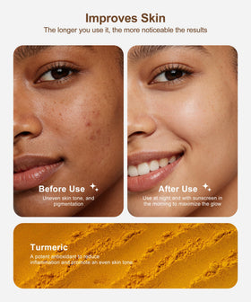 NOOROLA Lemon Turmeric Kojic Soap ingredients close-up with hyaluronic acid and shea butter nourishment
