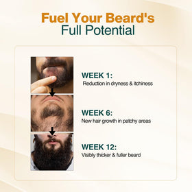 NOURISH MANTRA Vitamin E beard support bottle promotes even growth.