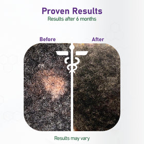 NouriTress image showing morning and night routine with the serum.