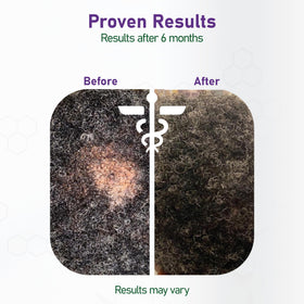 NouriTress Perfect Hair Vitamins Plus label detail with key ingredients