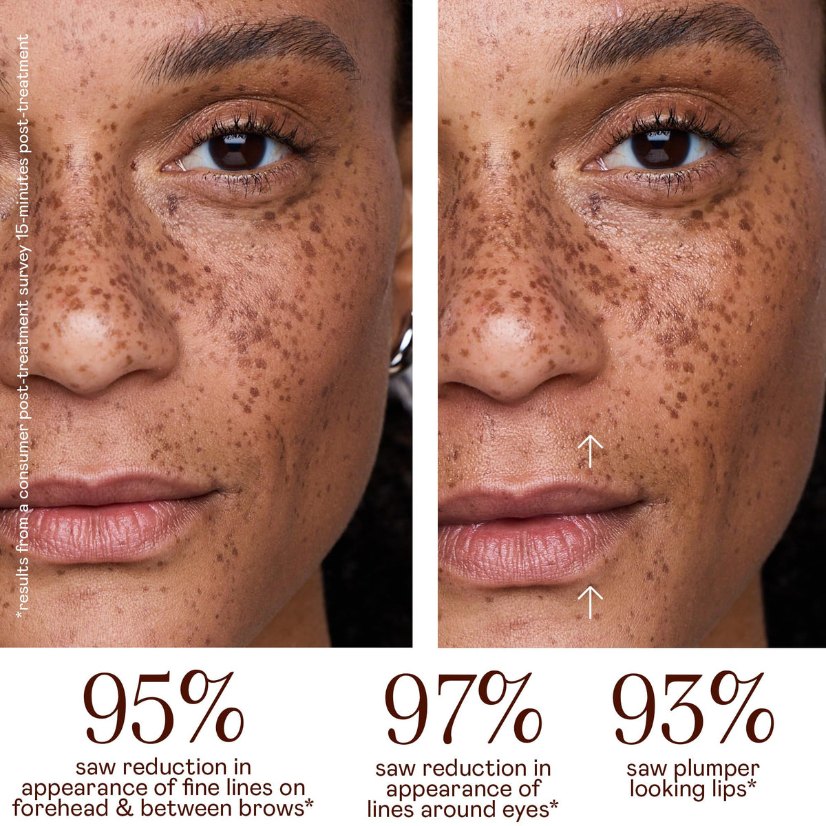 NuFACE FIX MicroWand used on forehead to smooth fine lines.