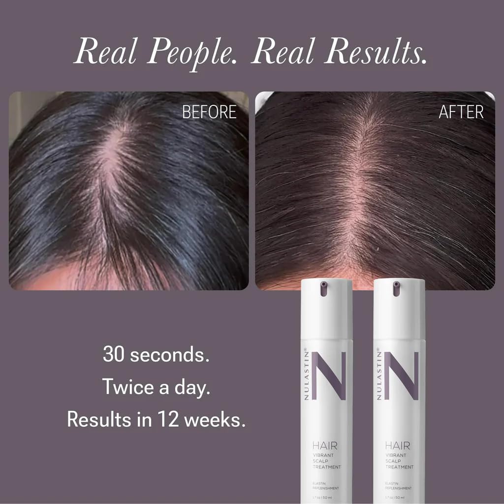 NULASTIN Scalp Serum applied on scalp targeting thinning areas for a fuller look.