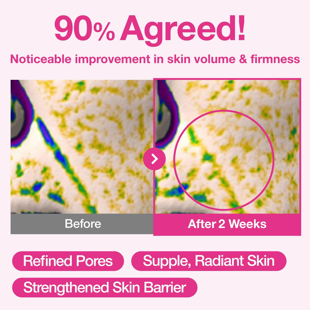 Numbuzin nine peptides supporting firming and elasticity