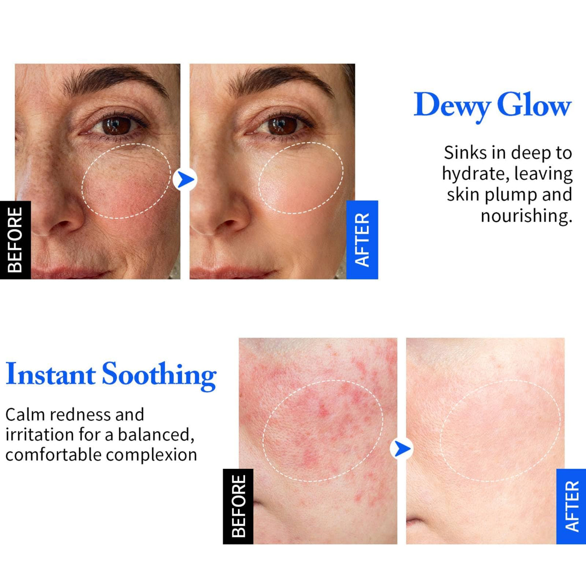 NUNUDA fragrance-free face cream application shows safe use for all skin types