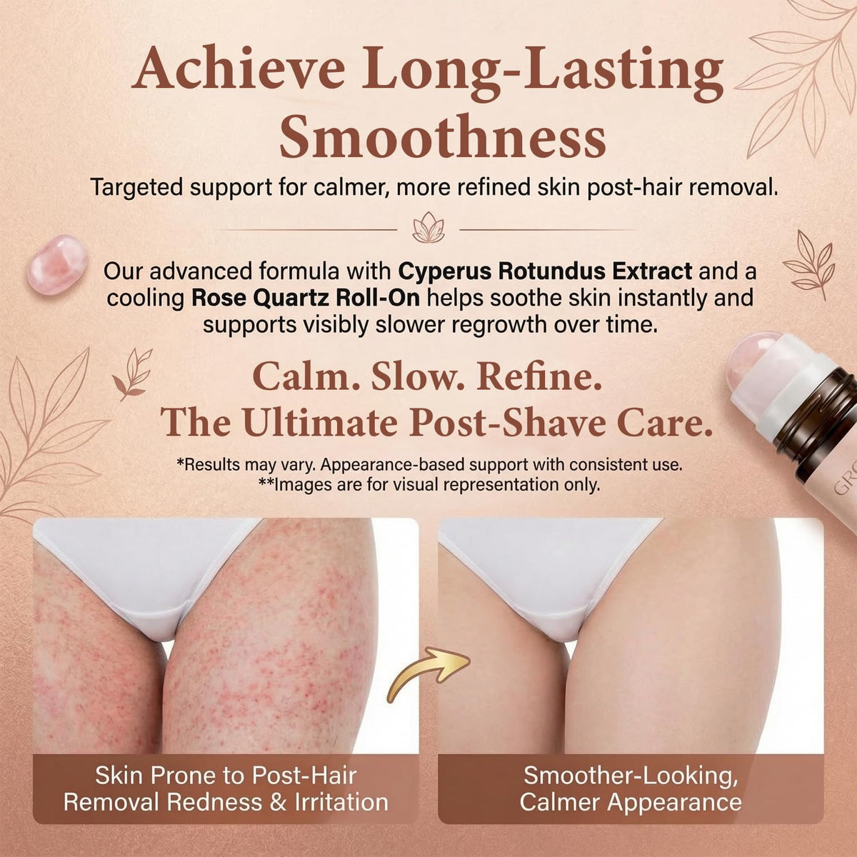 NUROOT jojoba-rosehip-almond blend supports softer-looking skin between grooming sessions.