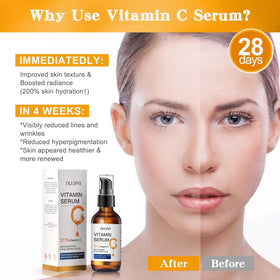NUSPA Serum close-up highlights dark spots and discoloration fading potential