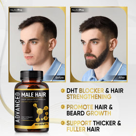 NutraPro beard growth capsules showing potential beard fullness support.