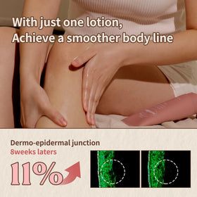 Hands massage Nutseline lotion into skin to promote smoother texture