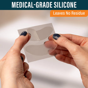 NUVADERMIS patches provide easy removal with no sticky residue.