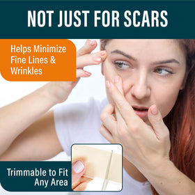 NUVADERMIS scar tape cut to fit scar for precise coverage