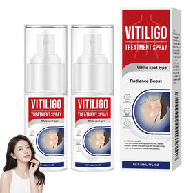 NYYQYYN Vitiligo Treatment Spray bottle for a more balanced complexion.