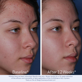Obagi CLENZIderm M.D. cleanser label highlights 2% salicylic acid.