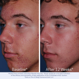 Obagi CLENZIderm M.D. cleanser menthol cooling effect close-up.