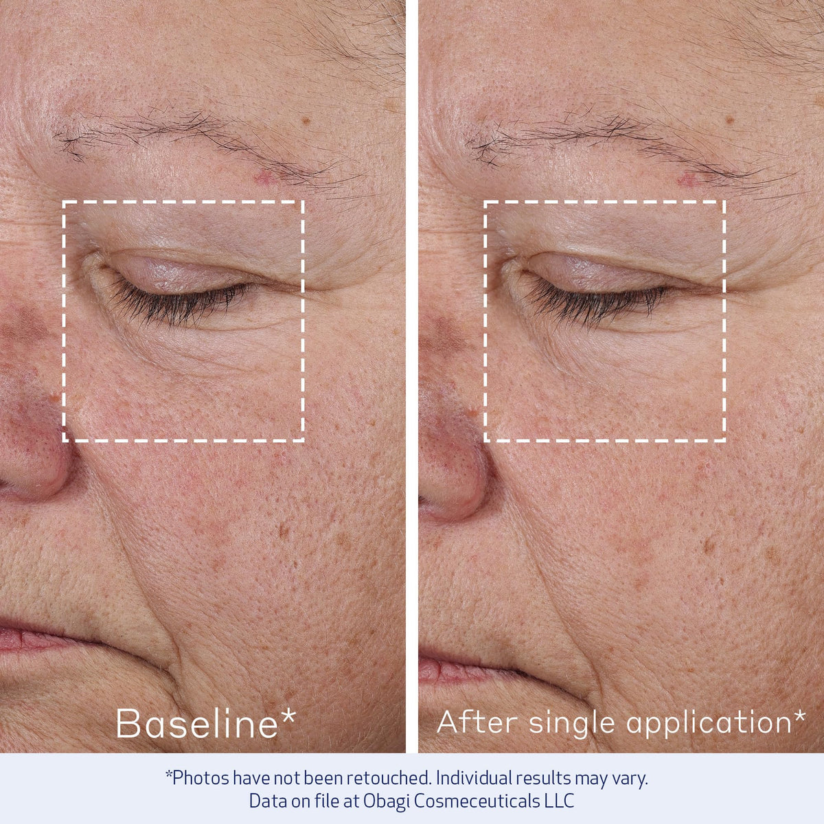 Obagi ELASTIderm applied with fingertips for smoother, non-greasy finish.