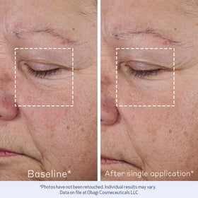 Obagi ELASTIderm applied with fingertips for smoother, non-greasy finish.