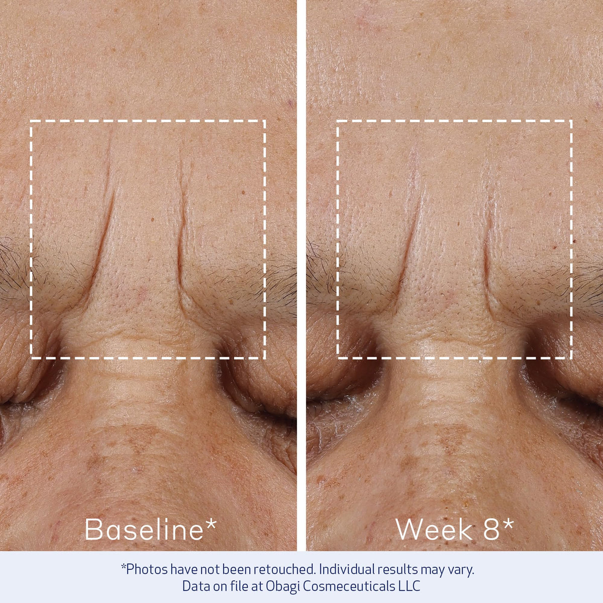 Obagi ELASTIderm supports at-home daily routine.