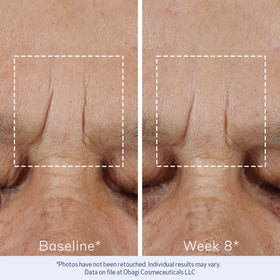 Obagi ELASTIderm supports at-home daily routine.