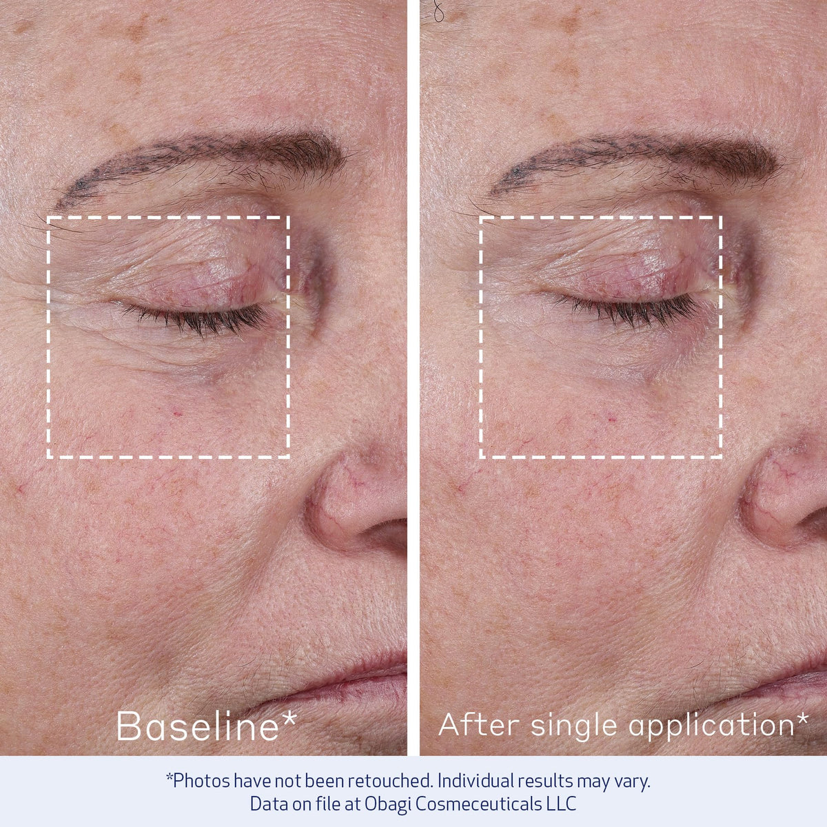 Box packaging highlights biomimetic peptide technology and clinical results.