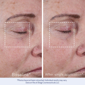 Box packaging highlights biomimetic peptide technology and clinical results.