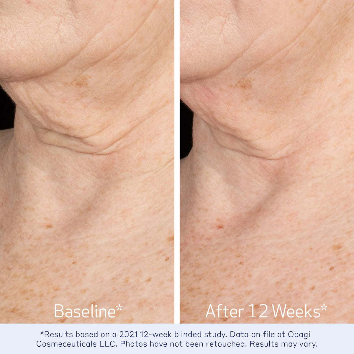 Obagi ELASTIderm Bi-Mineral Contour Complex graphic explains elastin support.