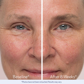 Obagi Nu-Cil 12-week progress visuals suggesting brow improvement