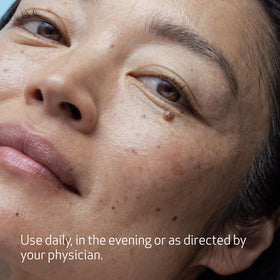 Obagi Nu-Derm Gentle Cleanser on hand applying a mild cleanse.