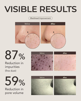 OBgE Blackhead Scrub Balm application with silicone brush unclogs pores without irritation.