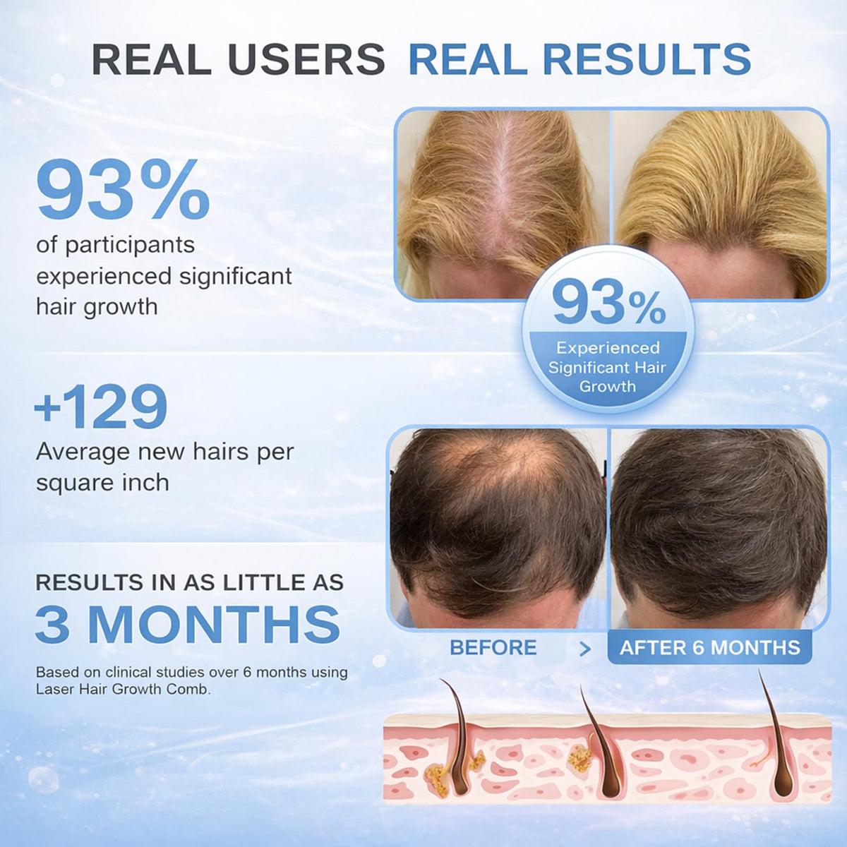 Obiredk Laser Hair Growth Comb detachable head image emphasizes easy cleaning after use.
