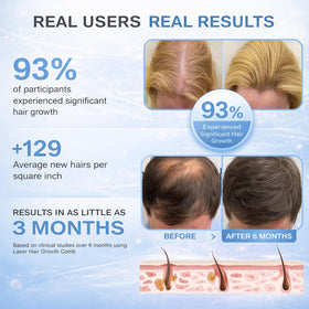 Obiredk Laser Hair Growth Comb detachable head image emphasizes easy cleaning after use.