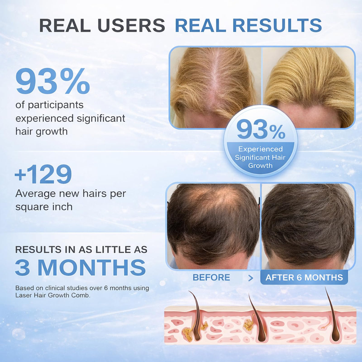 Obiredk Laser Hair Growth Comb in charging base for rechargeability.