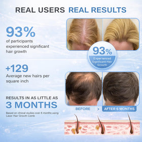 Obiredk Laser Hair Growth Comb in charging base for rechargeability.