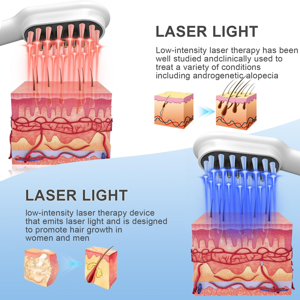 Obiredk Laser Hair Growth Comb portable cordless design enables use at home or on the go.