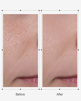 OGANACELL DERX Cleanser provides hydrating, pH balanced daily cleanse.