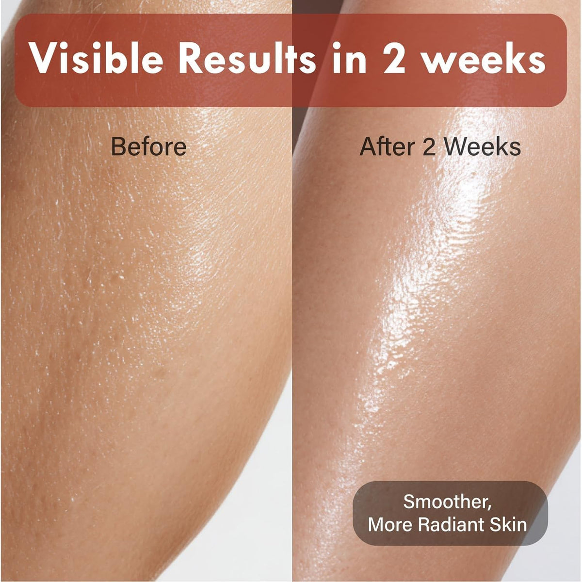Applying OHMIA lotion on forearm demonstrates quick absorption